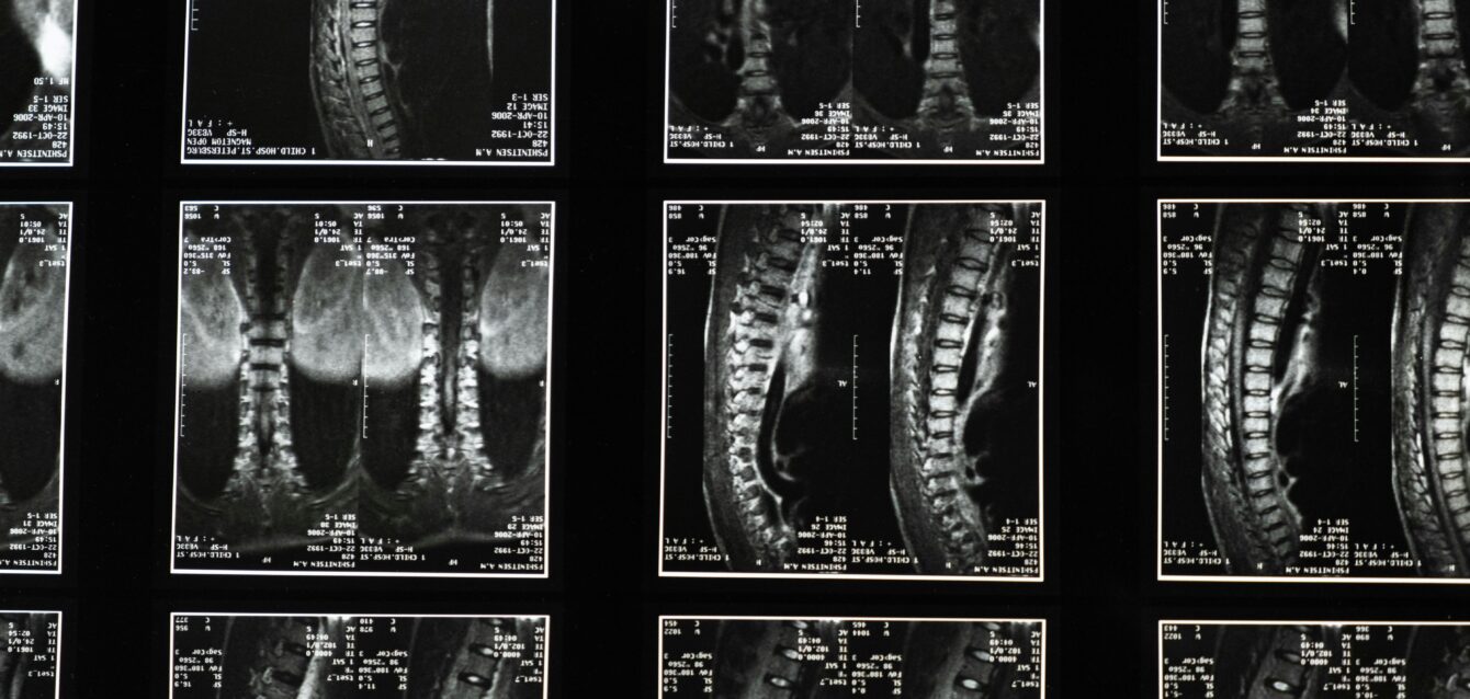 spine_2 spine_2